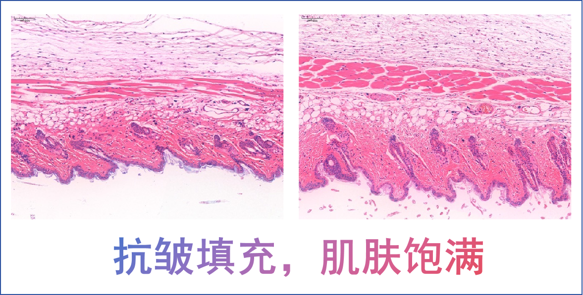 涂抹式抗皱技术